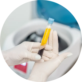 Regenerative therapy sample tube for Well Infused wellness care