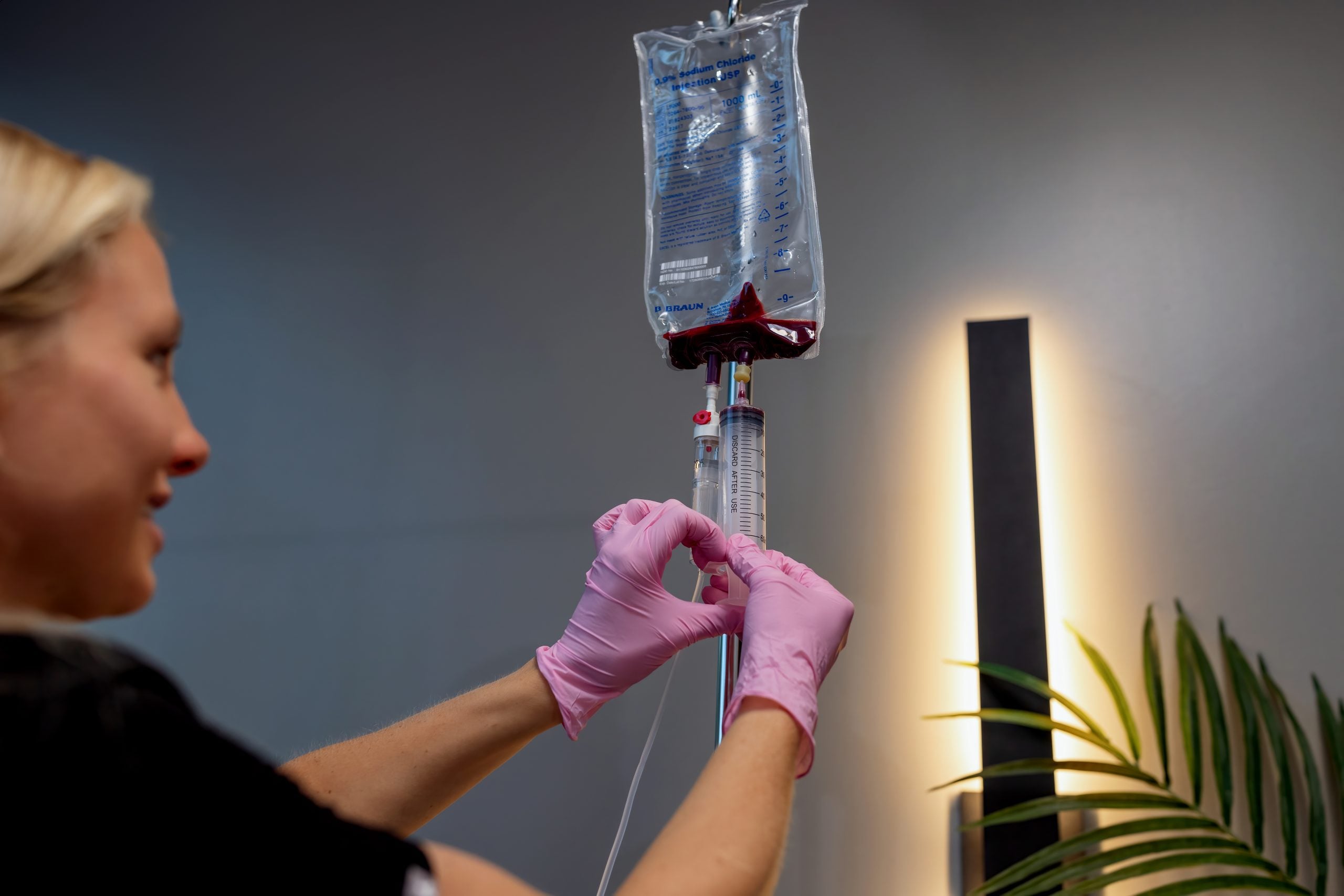 Ozone therapy treatment setup with IV bag and tubing