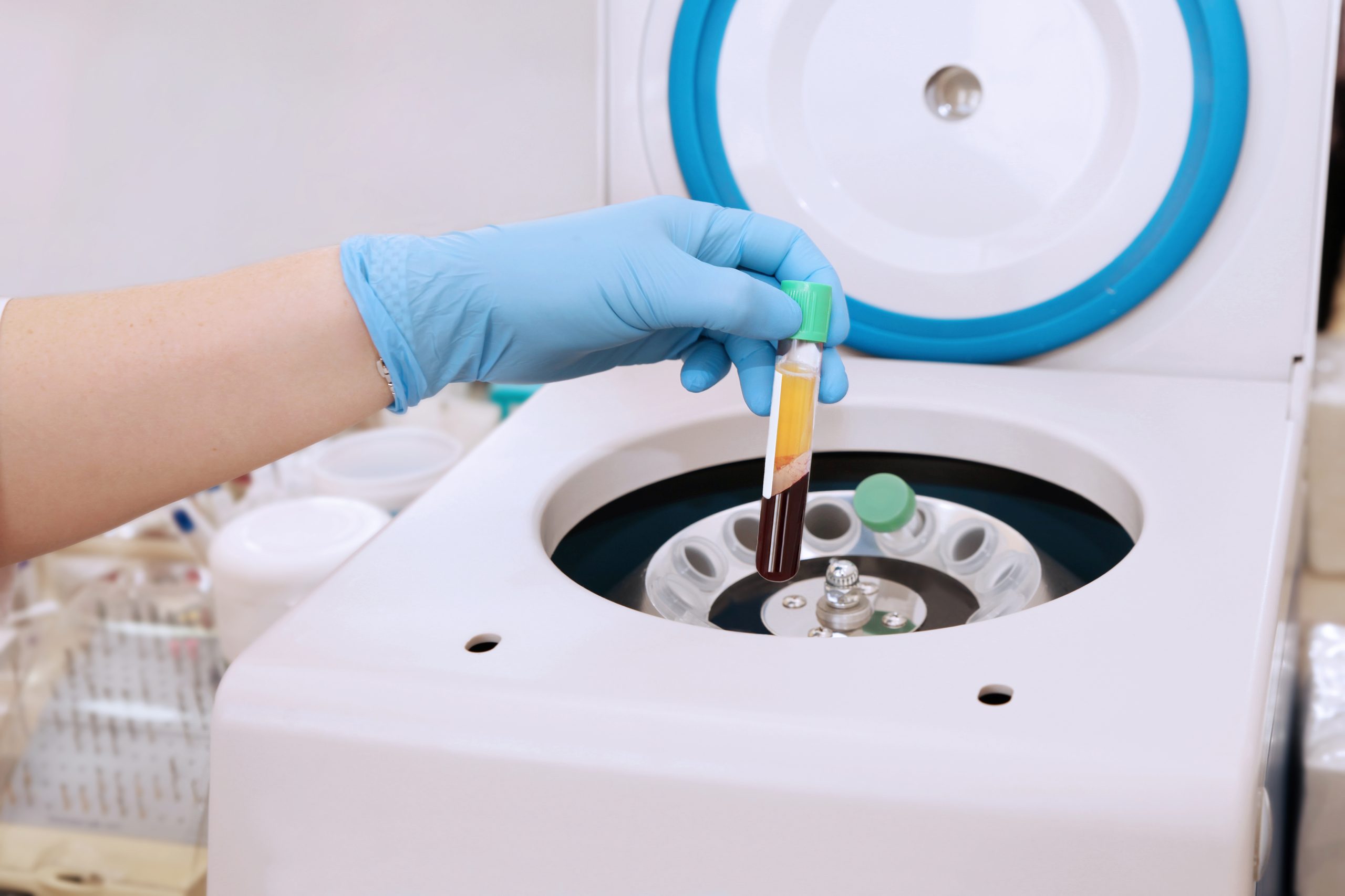 Platelet rich plasma PRP preparation in a centrifuge for regenerative medicine